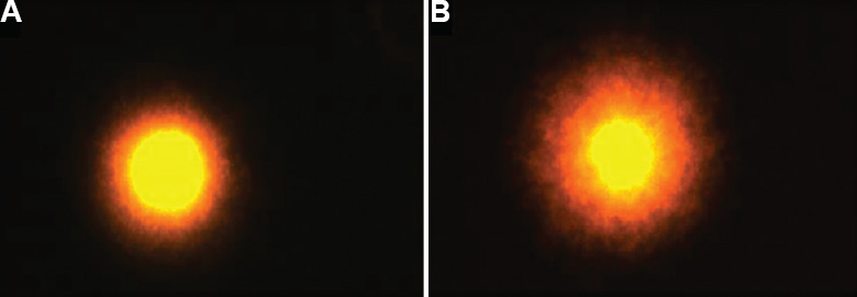 Comet assay of sperm cells: (A) intact and (B) fragmented comet tail DNA.